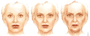 Aging temples changes shape of face